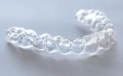 High-resolution image showing precision-trimmed edges of a clear orthodontic aligner.
