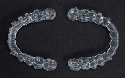 Upper and lower aligner trays side by side, showcasing their customized design.