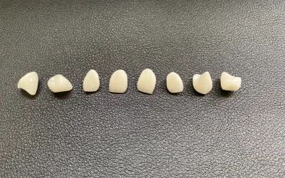 Set of ceramic dental crowns