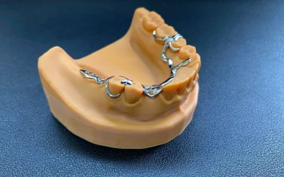 Jaw model showing removable dental framework