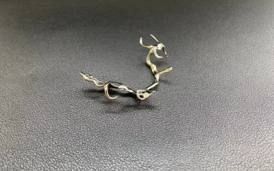 Cast metal dental structure with clasps