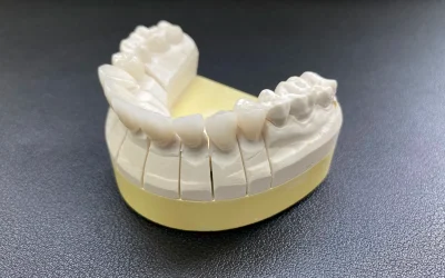 Full-arch zirconia crowns on a dental model