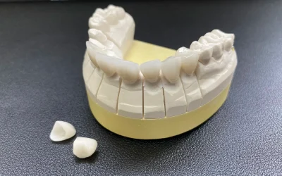 Segmented dental model with fixed crowns.