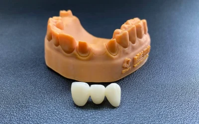 Simulated molar crowns on a jaw mold.