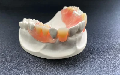 Acrylic partial denture on dental cast